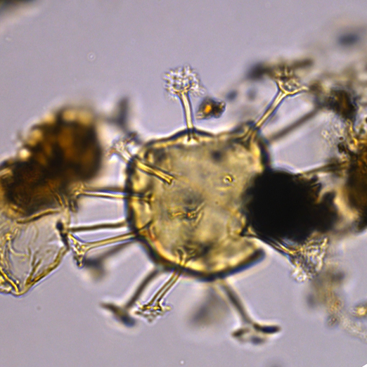 Hystrichosphaeridium tubiferum Hel27X3606210b 40x.jpg